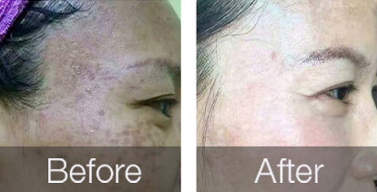 before-after-03