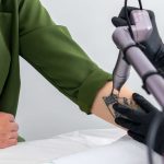 Tattoo-Removal